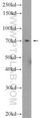Zinc Finger Protein 695 antibody, 25556-1-AP, Proteintech Group, Western Blot image 
