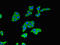 Beta-Transducin Repeat Containing E3 Ubiquitin Protein Ligase antibody, CSB-PA897464LA01HU, Cusabio, Immunofluorescence image 