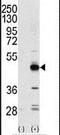 Tribbles Pseudokinase 3 antibody, PA5-15479, Invitrogen Antibodies, Western Blot image 