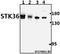 Serine/Threonine Kinase 36 antibody, A09526, Boster Biological Technology, Western Blot image 