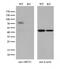 ATP Binding Cassette Subfamily F Member 2 antibody, M10873, Boster Biological Technology, Western Blot image 