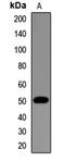 Tubulin beta antibody, LS-C668938, Lifespan Biosciences, Western Blot image 