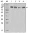 Protein Tyrosine Kinase 2 Beta antibody, AM06233SU-N, Origene, Western Blot image 