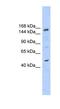 SNF2 Histone Linker PHD RING Helicase antibody, NBP1-57190, Novus Biologicals, Western Blot image 