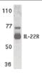 Interleukin 22 Receptor Subunit Alpha 1 antibody, orb87322, Biorbyt, Western Blot image 
