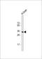 Glycine N-Methyltransferase antibody, 59-615, ProSci, Western Blot image 