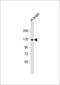 ACK1 antibody, 63-155, ProSci, Western Blot image 