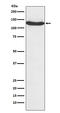 Heterogeneous Nuclear Ribonucleoprotein U antibody, M03691, Boster Biological Technology, Western Blot image 