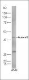 Aurora Kinase B antibody, orb13268, Biorbyt, Western Blot image 