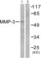 Matrix Metallopeptidase 3 antibody, abx013149, Abbexa, Western Blot image 