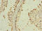 TNF Superfamily Member 9 antibody, LS-C675431, Lifespan Biosciences, Immunohistochemistry paraffin image 