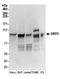 Oxysterol Binding Protein Like 3 antibody, A304-557A, Bethyl Labs, Western Blot image 