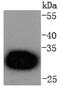 Cyclin Dependent Kinase 4 antibody, NBP2-67736, Novus Biologicals, Western Blot image 