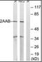 Protein Phosphatase 2 Scaffold Subunit Abeta antibody, orb95400, Biorbyt, Western Blot image 