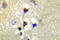 Serine/threonine-protein kinase D1 antibody, LS-C291518, Lifespan Biosciences, Immunohistochemistry paraffin image 