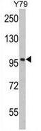 Karyopherin Subunit Beta 1 antibody, GTX81705, GeneTex, Western Blot image 