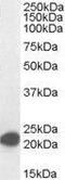 MYC Associated Factor X antibody, GTX89997, GeneTex, Western Blot image 