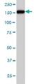 Non-SMC Condensin I Complex Subunit D2 antibody, H00009918-M01, Novus Biologicals, Western Blot image 