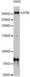 ATM Serine/Threonine Kinase antibody, A5908, ABclonal Technology, Western Blot image 