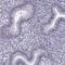 Shugoshin 1 antibody, HPA069857, Atlas Antibodies, Immunohistochemistry paraffin image 