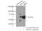 STEAP3 Metalloreductase antibody, 17186-1-AP, Proteintech Group, Immunoprecipitation image 