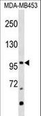 Nuclear Receptor Subfamily 3 Group C Member 2 antibody, LS-C158423, Lifespan Biosciences, Western Blot image 