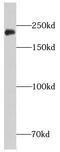 Chromodomain Helicase DNA Binding Protein 3 antibody, FNab01642, FineTest, Western Blot image 