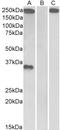 Thrombospondin 1 antibody, STJ71828, St John