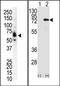 Protein Kinase C Eta antibody, AP13549PU-N, Origene, Western Blot image 