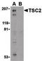 TSC Complex Subunit 2 antibody, PA5-20132, Invitrogen Antibodies, Western Blot image 