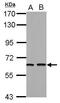 TUB Bipartite Transcription Factor antibody, GTX118348, GeneTex, Western Blot image 