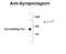 Ubiquitin C-Terminal Hydrolase L1 antibody, 50-263, ProSci, Western Blot image 