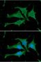 Calmodulin antibody, NBP1-04268, Novus Biologicals, Immunocytochemistry image 