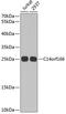 RNA Transcription, Translation And Transport Factor antibody, GTX32482, GeneTex, Western Blot image 