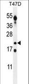 Cancer/Testis Antigen Family 45 Member A3 antibody, LS-C203654, Lifespan Biosciences, Western Blot image 