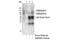 Gamma-Aminobutyric Acid Type B Receptor Subunit 1 antibody, 3835S, Cell Signaling Technology, Immunoprecipitation image 