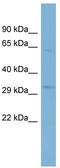 STIM Activating Enhancer antibody, TA333351, Origene, Western Blot image 