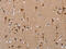 Protein O-mannosyl-transferase 1 antibody, CSB-PA125511, Cusabio, Immunohistochemistry paraffin image 