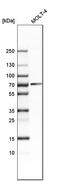 Chromatin assembly factor 1 subunit B antibody, HPA021679, Atlas Antibodies, Western Blot image 