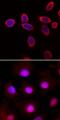Transforming Growth Factor Beta 1 Induced Transcript 1 antibody, AF5626, R&D Systems, Immunocytochemistry image 