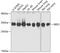 SBDS Ribosome Maturation Factor antibody, A02396, Boster Biological Technology, Western Blot image 