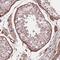HAS1 antibody, PA5-64330, Invitrogen Antibodies, Immunohistochemistry frozen image 