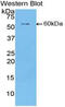 Cartilage Intermediate Layer Protein antibody, MBS2006189, MyBioSource, Western Blot image 