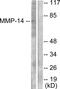 Matrix Metallopeptidase 14 antibody, LS-C118521, Lifespan Biosciences, Western Blot image 