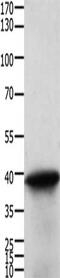 Tropomyosin 2 antibody, CSB-PA077768, Cusabio, Western Blot image 