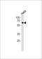 Nuclear Receptor Subfamily 1 Group D Member 2 antibody, PA5-35159, Invitrogen Antibodies, Western Blot image 