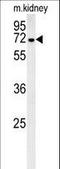 Glucosamine (UDP-N-Acetyl)-2-Epimerase/N-Acetylmannosamine Kinase antibody, LS-C166560, Lifespan Biosciences, Western Blot image 