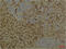 Aryl Hydrocarbon Receptor Nuclear Translocator antibody, GTX34039, GeneTex, Immunohistochemistry paraffin image 