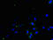 Transforming Growth Factor Alpha antibody, CSB-PA07294A0Rb, Cusabio, Immunofluorescence image 