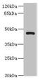 Vesicle Amine Transport 1 Like antibody, CSB-PA875723LA01HU, Cusabio, Western Blot image 